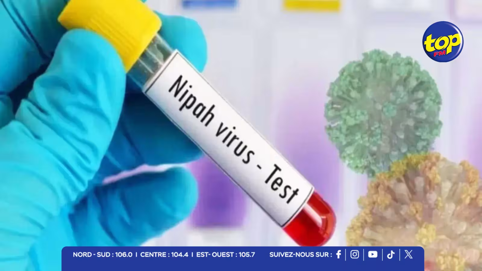 Virus Nipah : le Japon teste un vaccin révolutionnaire, la phase clinique en avril en Belgique