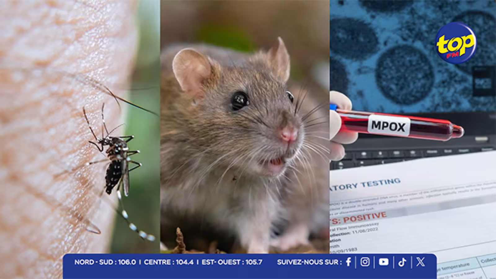Urgence sanitaire à Maurice : La barre des 1 700 cas de chikungunya franchie, 18 cas de leptospirose et 2 cas de Mpox sous haute surveillance