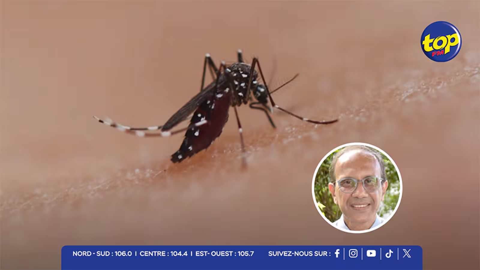 Chikungunya : deuxième cas confirmé à Plaisance Rose-Hill, la patiente admise à l’hôpital Victoria