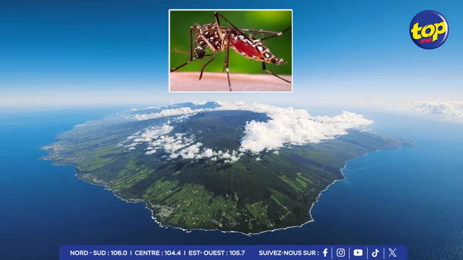 Chikungunya