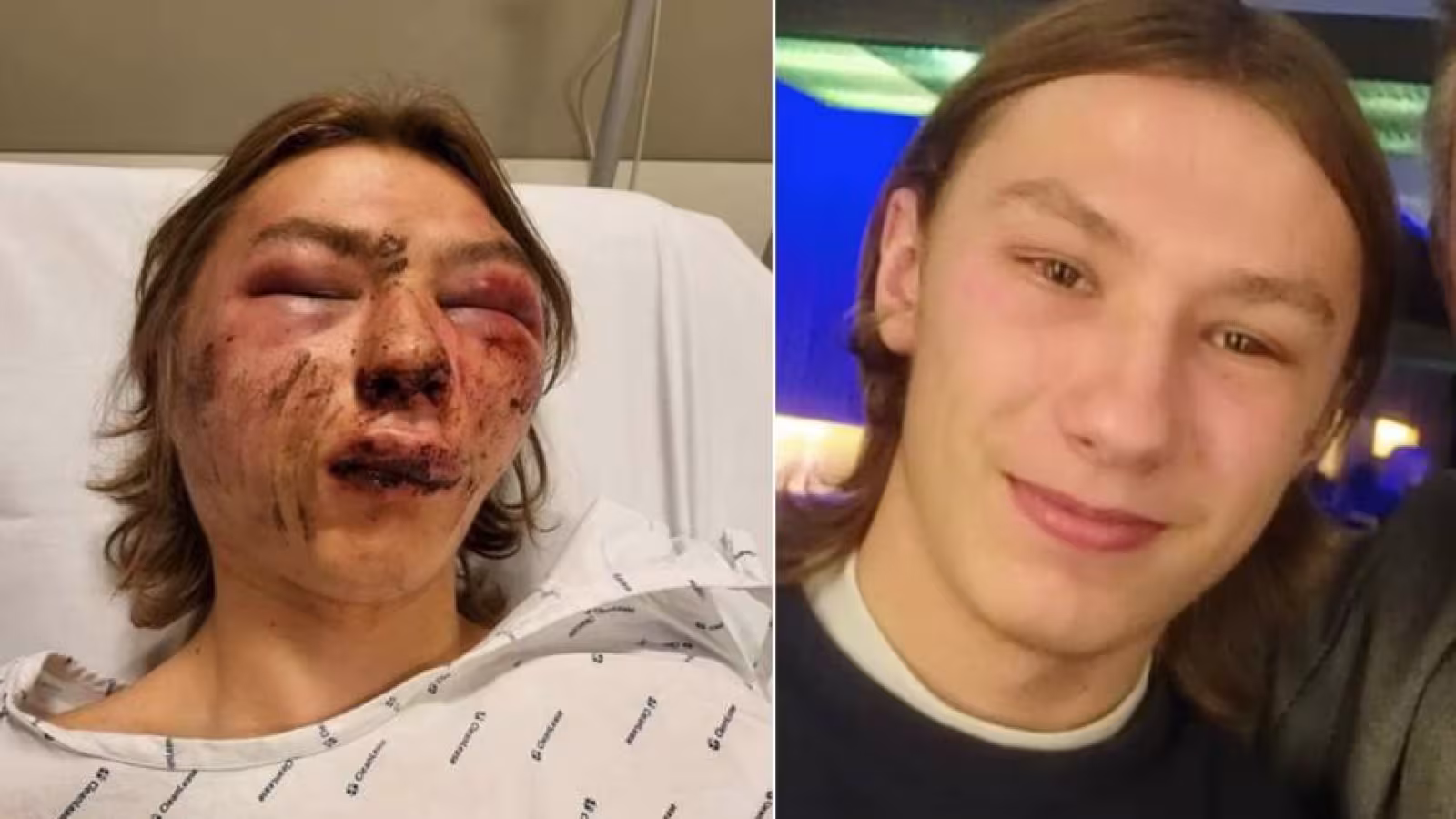 Un ado de 15 ans tabassé pendant 1 heure par 5 jeunes: La scène filmée et diffusée sur internet