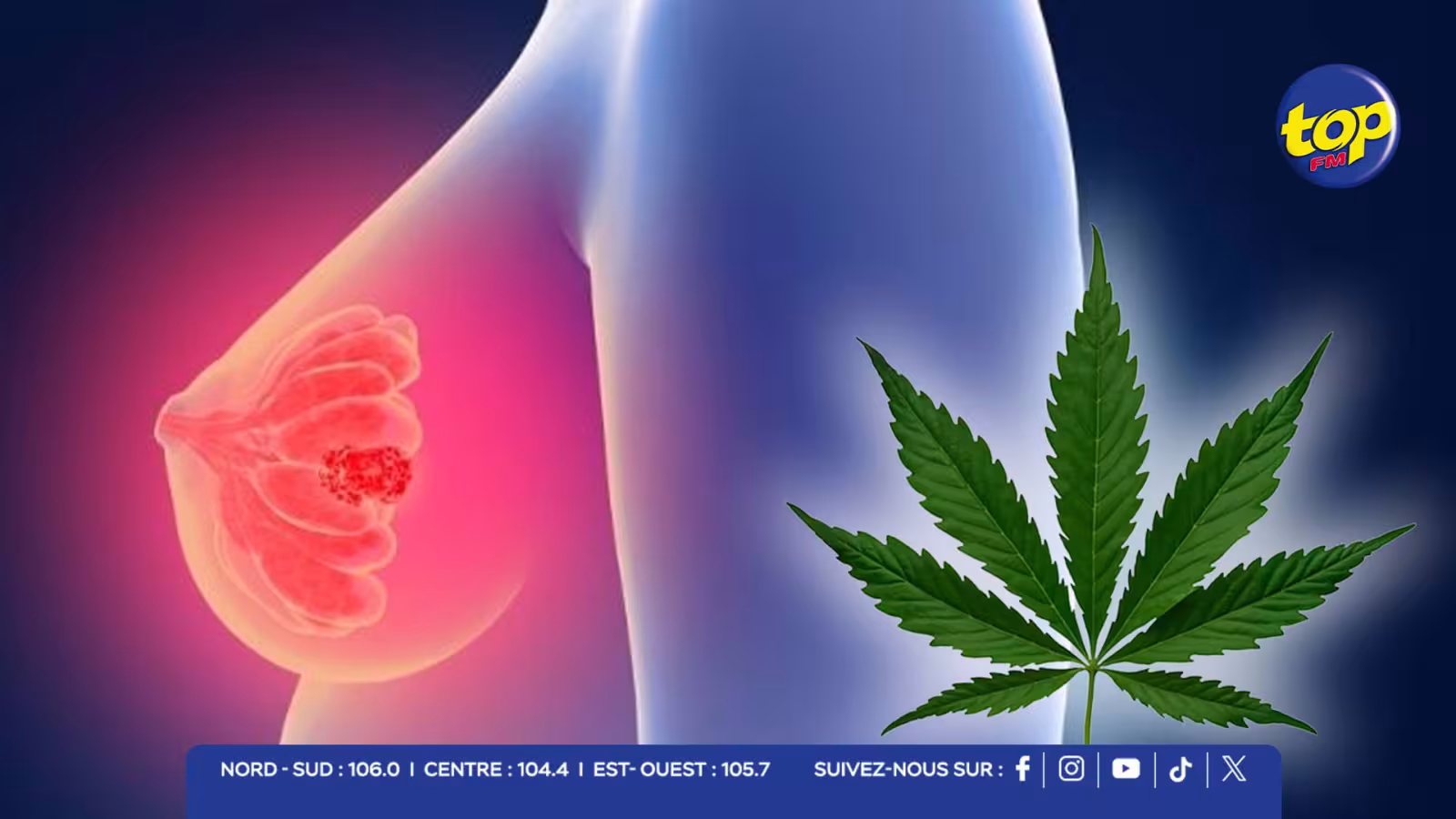 Cancer du sein : un composé du cannabis pourrait freiner l’agressivité tumorale