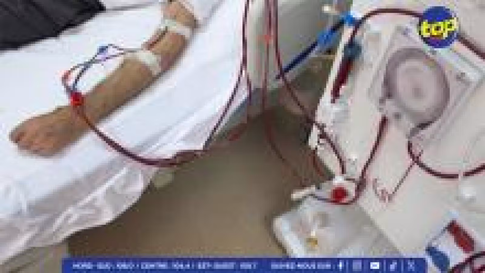 Dialyse : « Les patients souffrent beaucoup et doivent être encadrés », souligne Anil Bachoo 