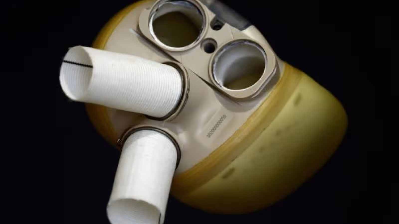 Premier implant commercial du cœur artificiel français Aeson