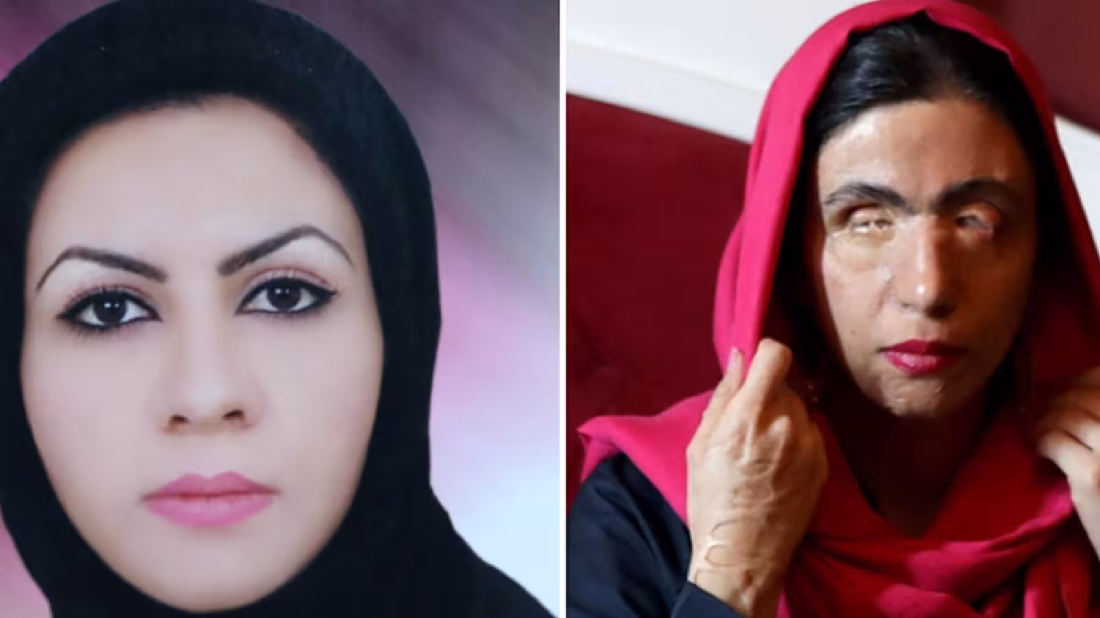 Dix ans après avoir été attaquée à l’acide, Masoumeh devient mannequin