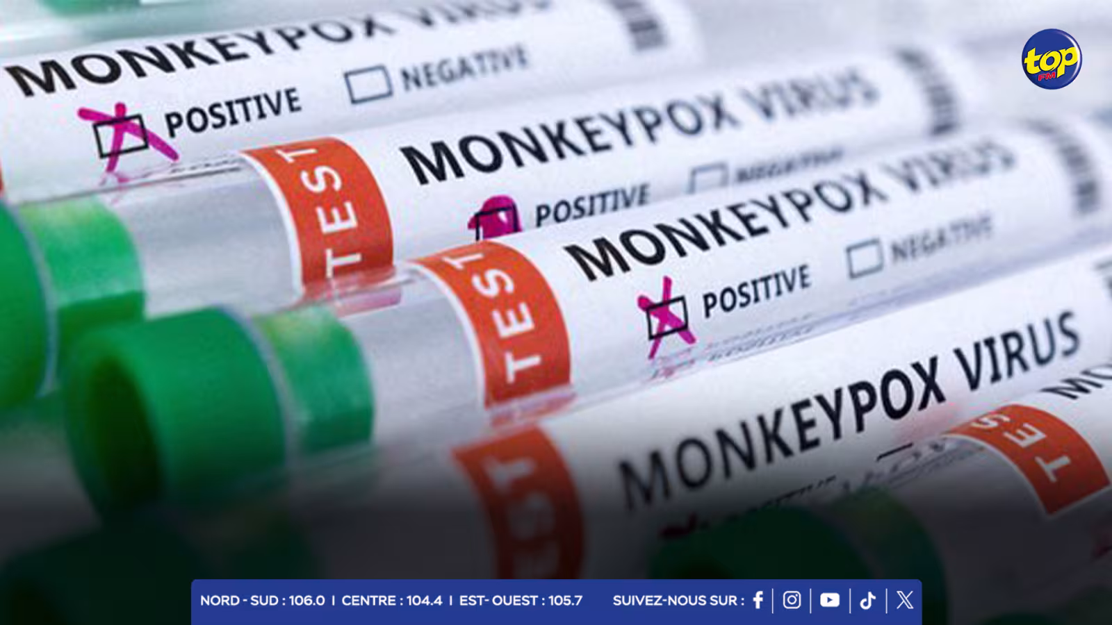 Santé :  le cabinet a pris note que la  Mpox ou variole du singe a été déclarée une urgence sanitaire internationale par l’Organisation mondiale de la santé 