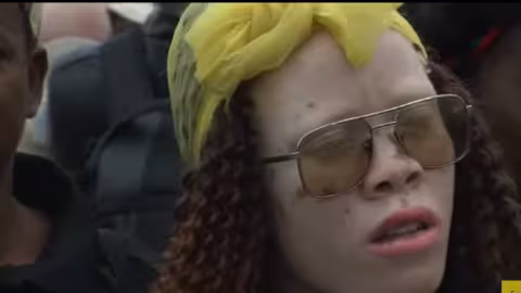 Cinq  Malawites, dont un prêtre catholique, condamnés à vie pour avoir tué et démembré un albinos à des fins de sorcellerie