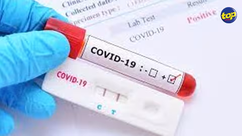 Covid-19 : 28 nouveaux cas locaux enregistrés ces dernières 24 heures