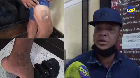 Brutalité policière alléguée : « Zot ine craze mo cheville… c’est après plus ki enn semaine ki zot ine amen moi l’hôpital », déplore Gérard Noël Catapermal…