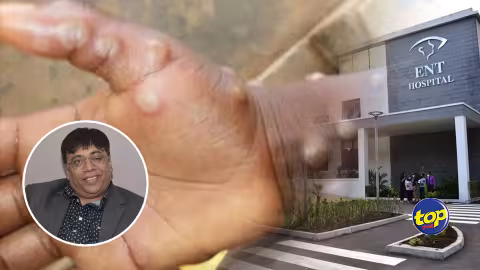Contamination à la variole du singe : la quarantaine est possible à l’hôtel, à domicile ou à l’hôpital ENT.