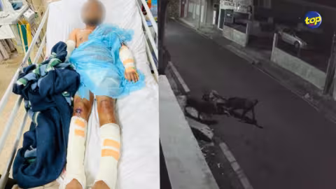 Agression par deux molosses : le comptable a subi une nouvelle intervention ce mardi