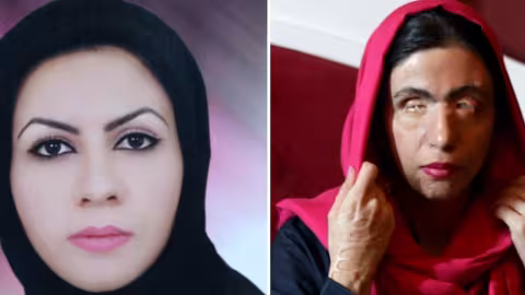 Dix ans après avoir été attaquée à l’acide, Masoumeh devient mannequin