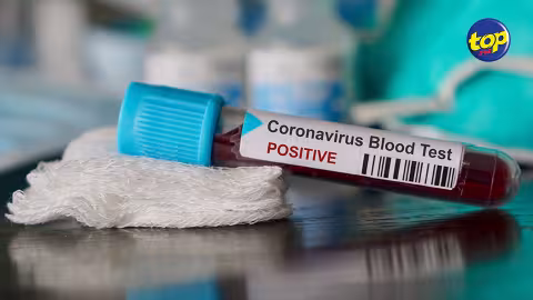 Covid 19 : toute une famille testée positive à Cluny
